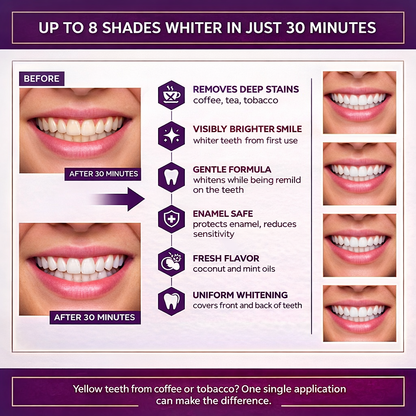 Purple Whitening Strips
