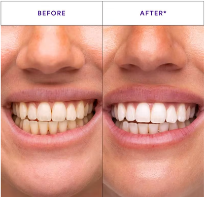 Purple Whitening Strips