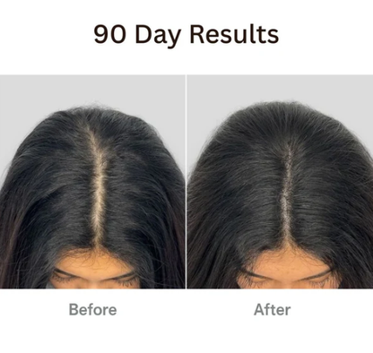 Natural 4-in-1 Hair Growth Brush